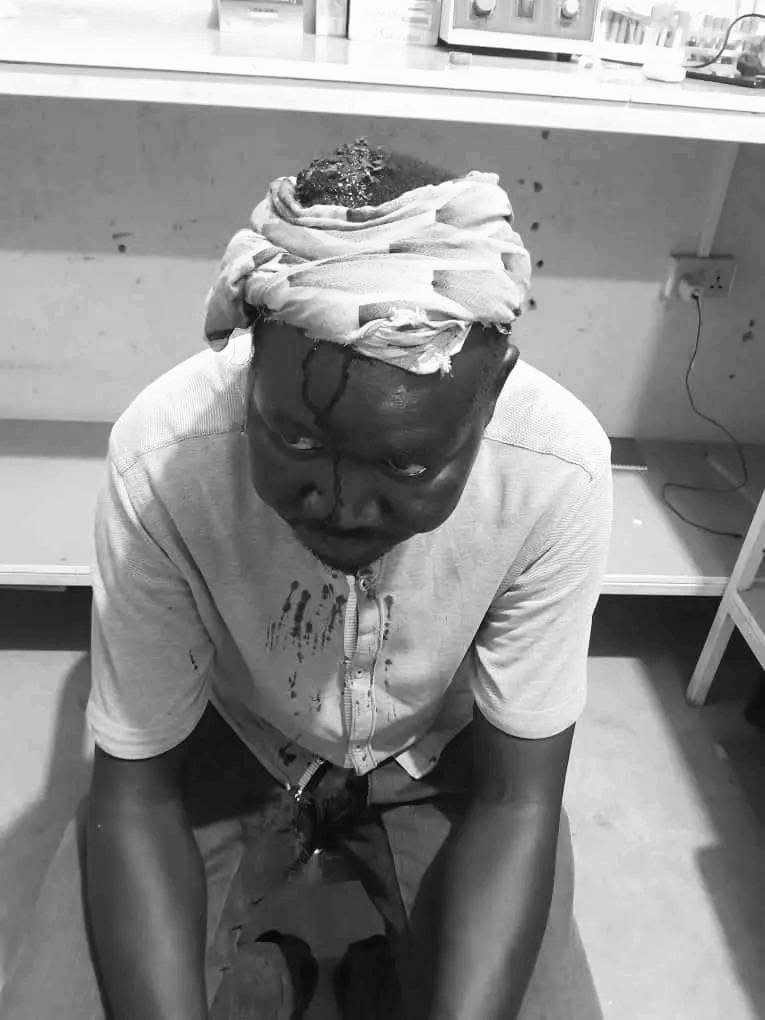 Panga Wielding Gangs Attack Reporter in Juba