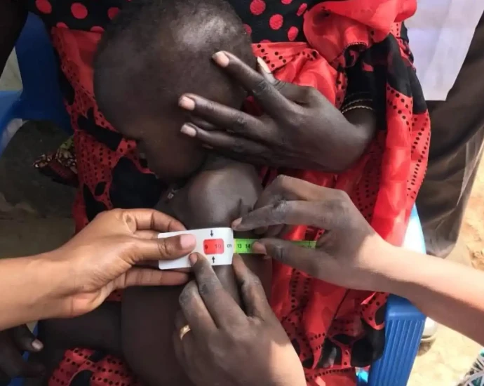 South Sudan Screens 72,000 Children for Malnutrition in Six Months