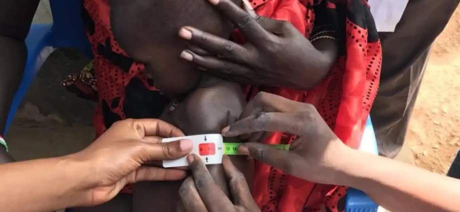 South Sudan Screens 72,000 Children for Malnutrition in Six Months